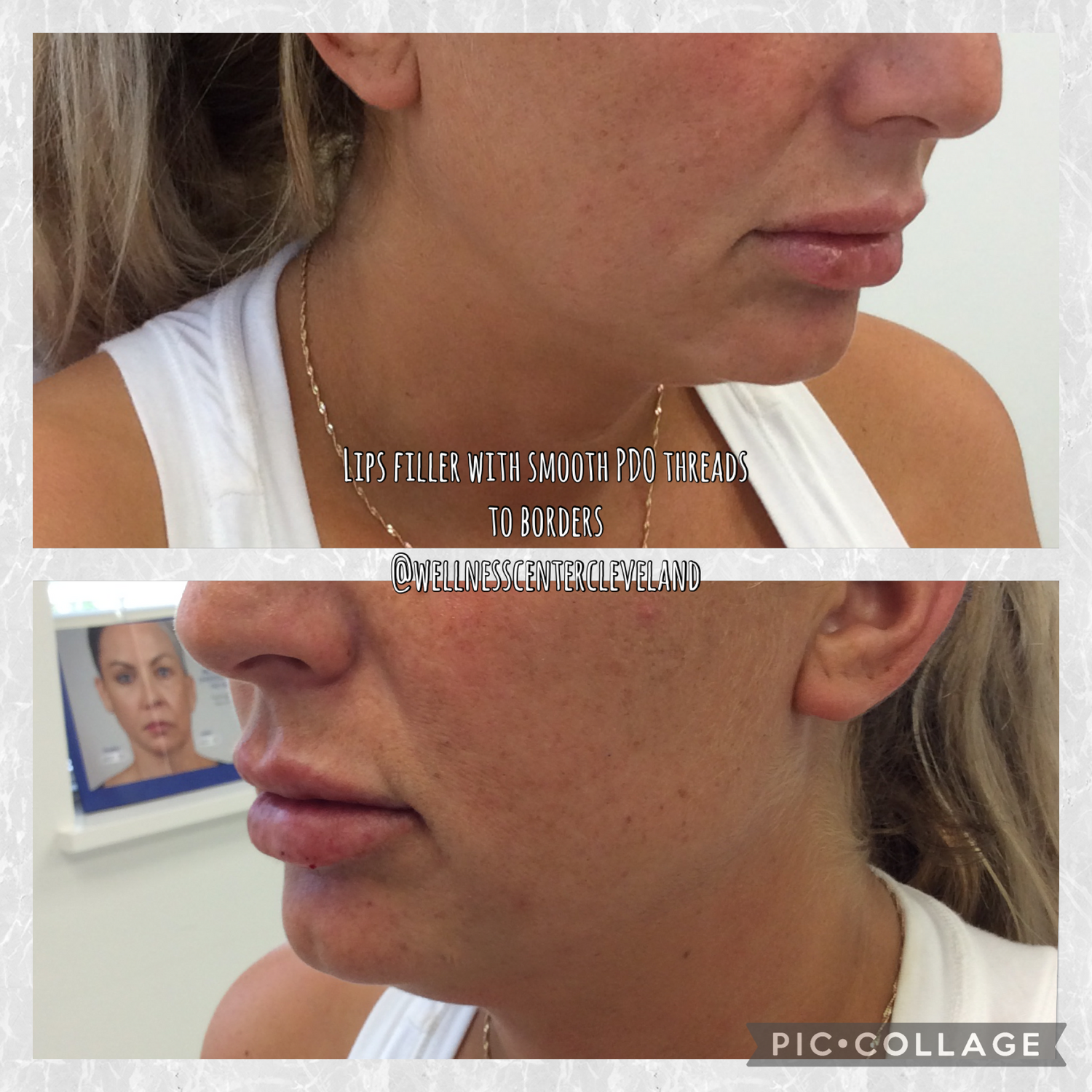 PDO Threads Before & After