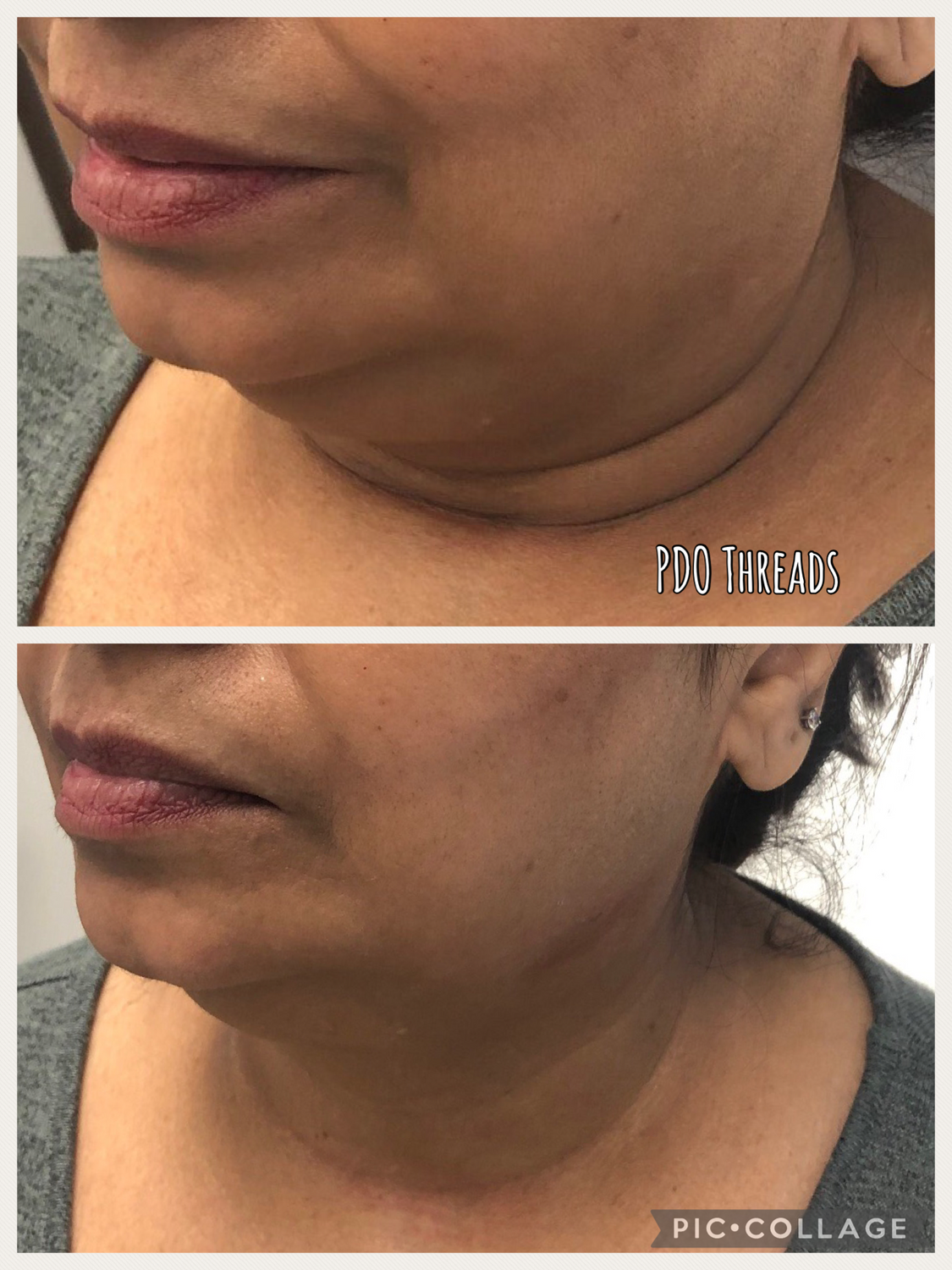 PDO Threads Before & After