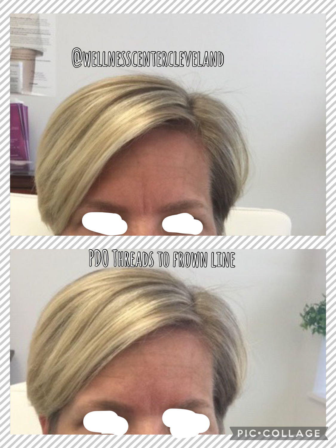 PDO Threads Before & After