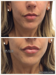 Before and After Photos Before & After