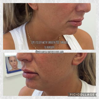 Before and After Photos Before & After