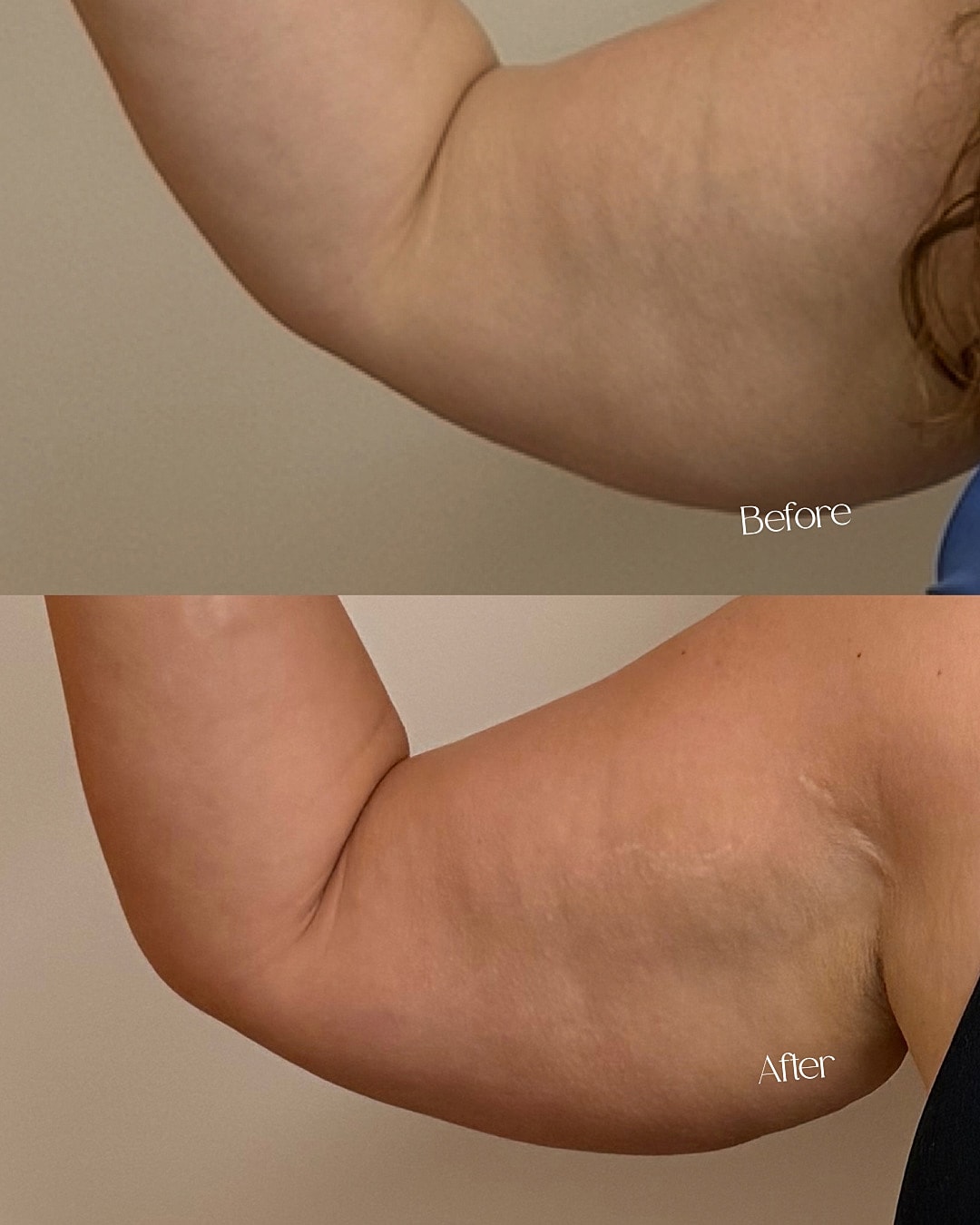 Onda Coolwave Before & After