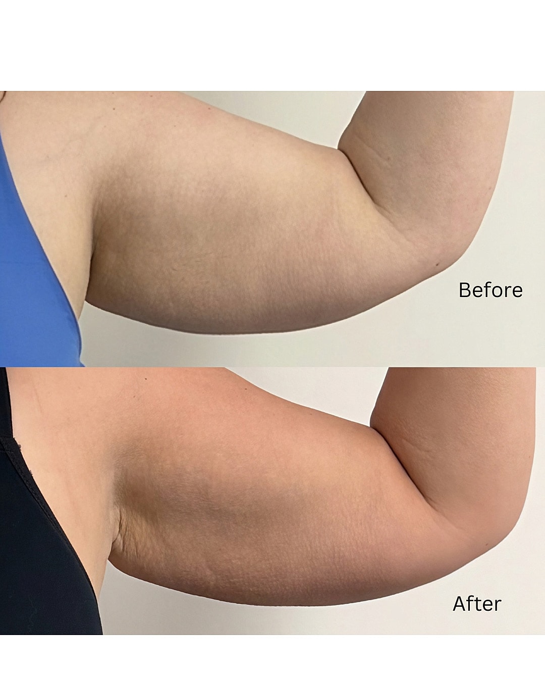 Onda Coolwave Before & After