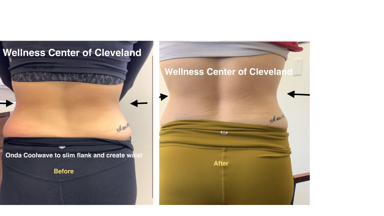 Onda Coolwave Before & After