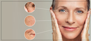 PDO Thread Lift Treatment Specialist Near Me in Cleveland, OH