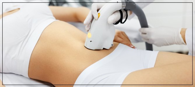 Cost of Laser Hair Removal Procedure Near Me in Cleveland OH